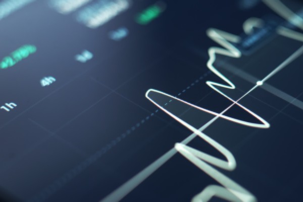 技术分析：以色列伊朗冲突引发避险情绪，日元短期有望走强？
